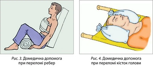 Перелом ребер - причины, симптомы, признаки, диагностика, первая помощь, лечение, реабилитация